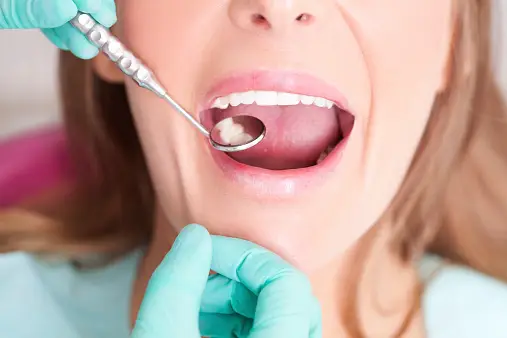 You are currently viewing Affordable Smiles: How Much Does a Filling Cost Without Insurance?